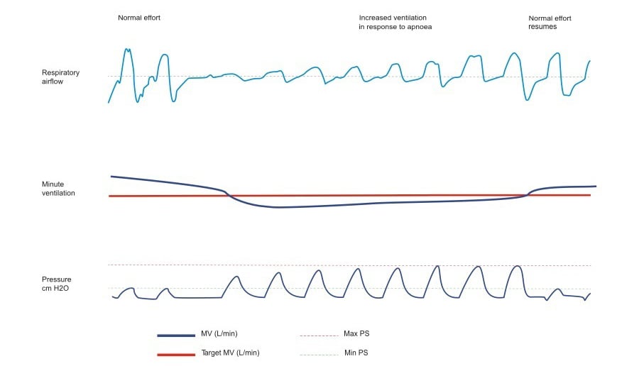 article-curves-1